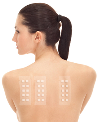 Filling the Gap in Patch Test Training » SmartPractice Blog